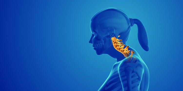 Understanding Turtle Neck Syndrome: Causes and Symptoms