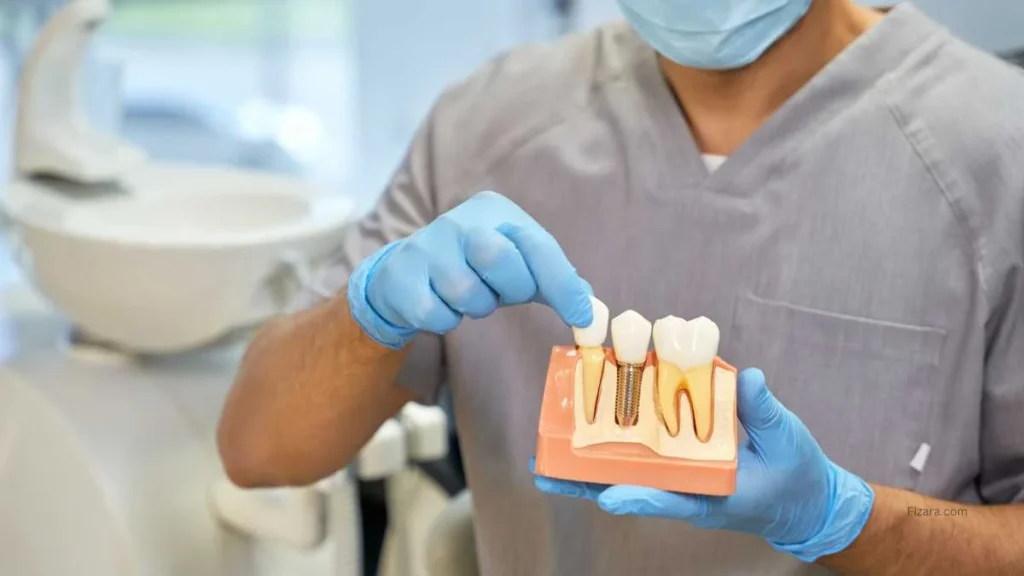 dental bridge vs implant