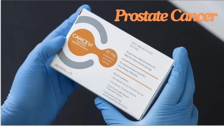 CAMCEVI for Prostate Cancer