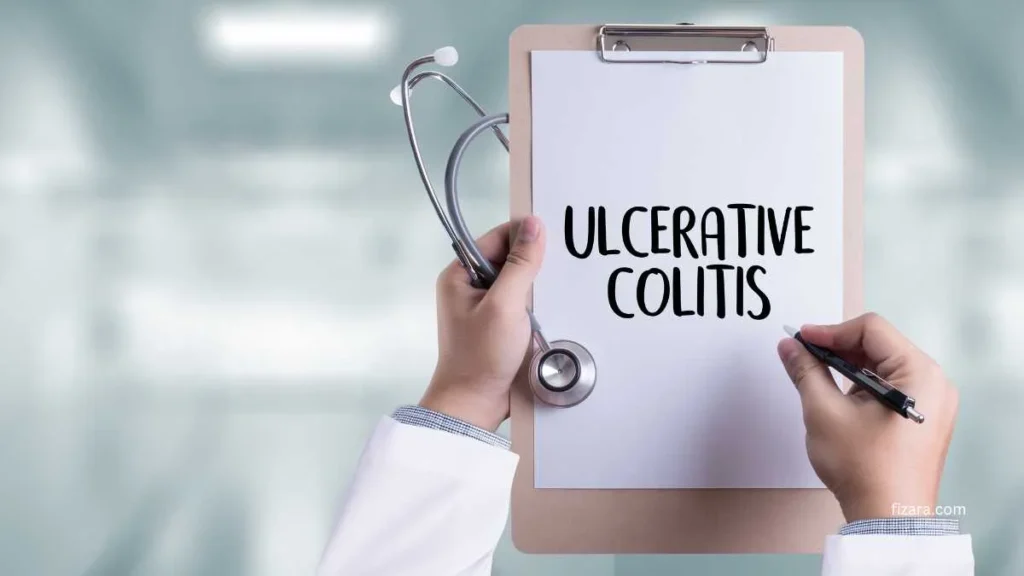 Ulcerative Colitis