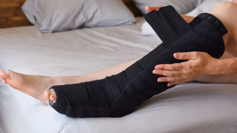 lymphedema