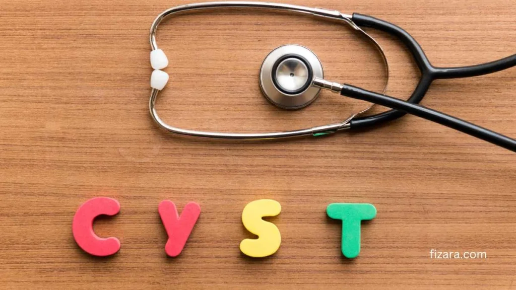 Cyst