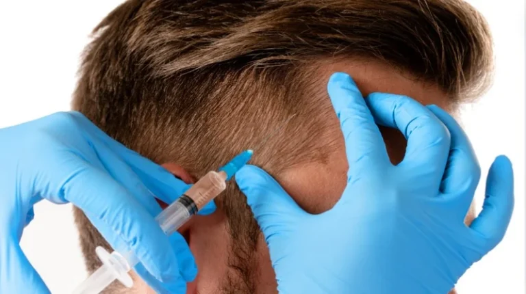 Minoxidil