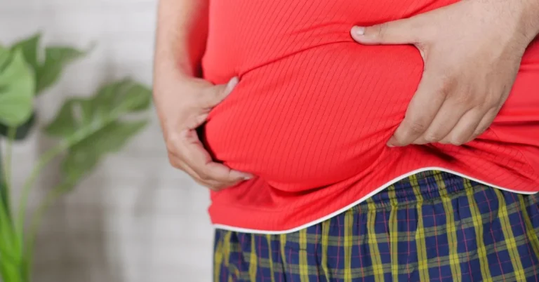 An apron belly, also known as a panniculus or pannus, is an overhanging flap of abdominal skin and fat that drapes down from the lower abdomen.