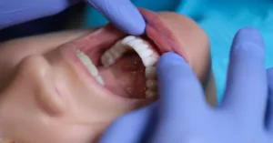 Grinded Teeth