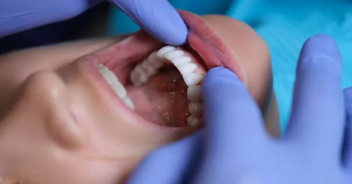 Grinded Teeth